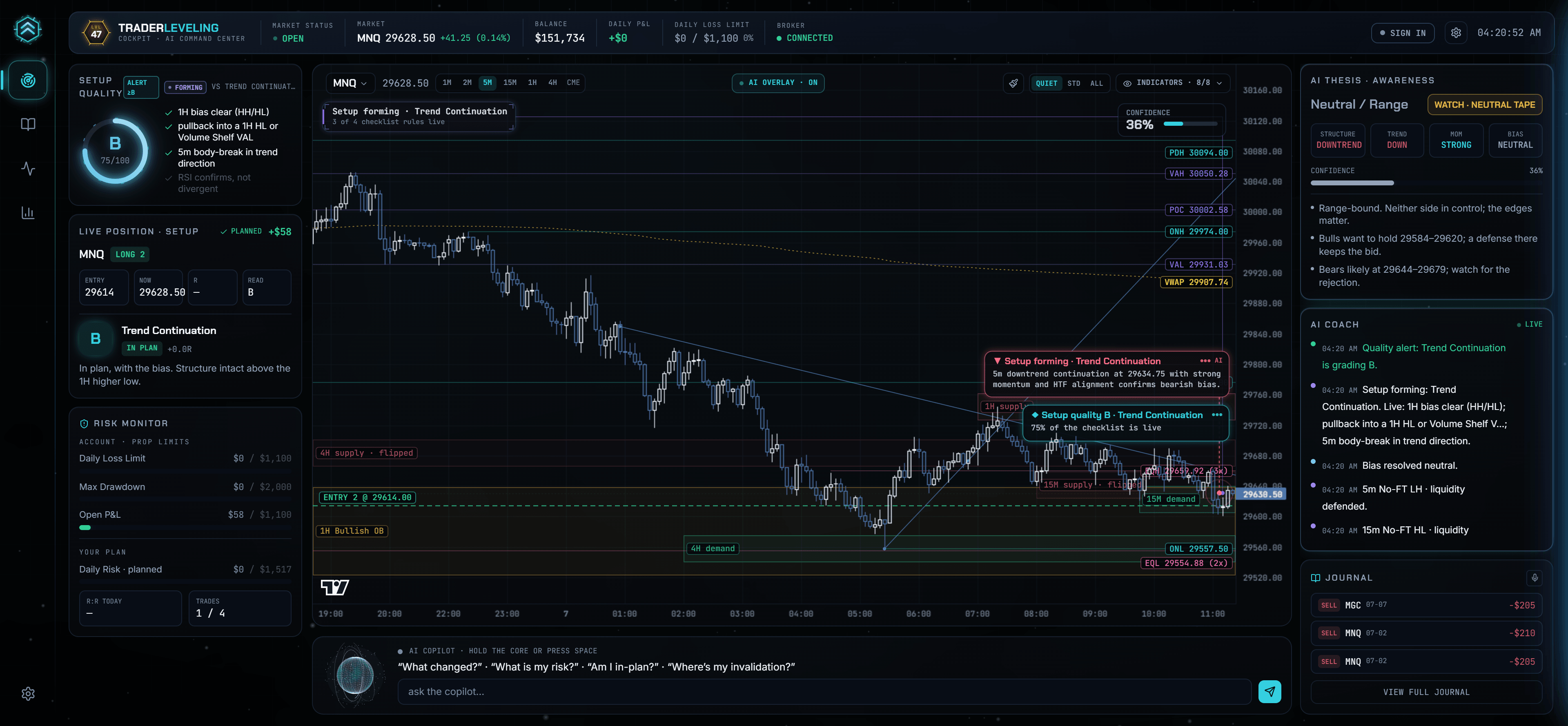 The actual TraderLeveling Terminal showing a live chart, setup checklist, local risk monitor, AI awareness, and journal context